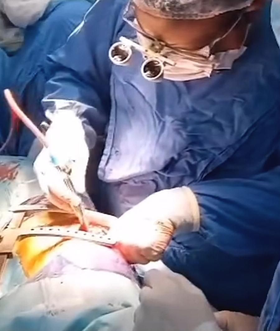 العملية الجراحية 