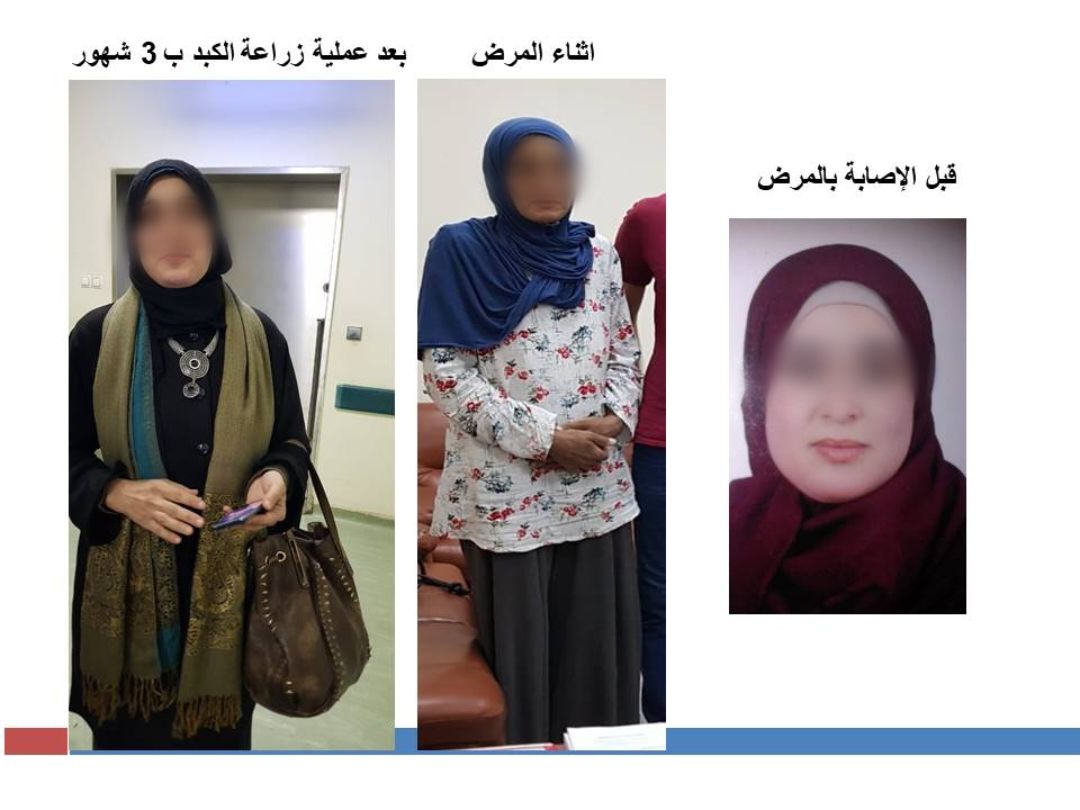 مرضة قبل وأثناء وبعد المرض