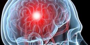 علماء يبتكرون نموذج ذكاء اصطناعي يشخص 6 أمراض دماغية بـ "بصمة دم"