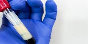 الدهون الثلاثية خطر صامت يستدعي الانتباه والوقاية