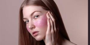 في الربيع.. نصائح تحمي بشرتك من التهيّج والجفاف