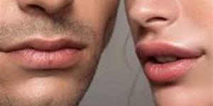 وصفات طبيعية لعلاج سواد الشفاه واستعادة نضارتها