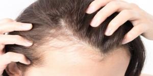 أطعمة تضعف الشعر وتزيد تساقطه.. عادات غذائية تهدد كثافته