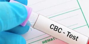 بعد سن الثلاثين.. تحاليل ضرورية لا يجب تجاهلها للحفاظ على صحتك