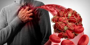 عادة بسيطة يوميًا قد تقلل خطر الجلطات.. ماذا يقول الأطباء؟