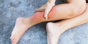 تجنبها.. أطعمة تحفز التهاب الأنسجة تحت الجلد وأبرز بدائلها المفيدة