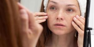 تأثير نقص فيتامين D على جسمك.. ما هي الأعراض وكيف تعالجها؟