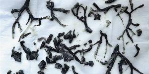 رجل يصاب بحالة نادرة بعد استنشاقه لدخان الحرائق (تفاصيل)