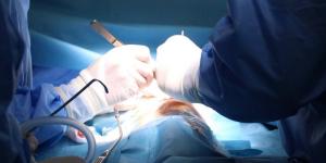 بعد فشل متكرر.. نجاح جراحة دقيقة لعلاج “الأكاليزيا” في كفر الشيخ
