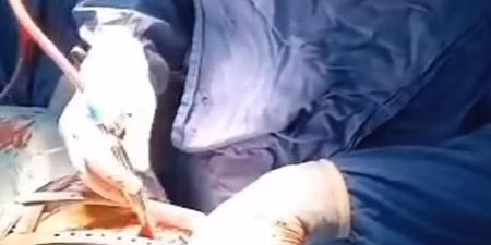ملحمة جراحية نادرة لإنقاذ قلب طفل في قصر العيني