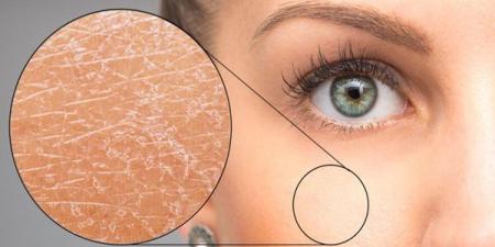 بعد الاستحمام.. عادة بسيطة قد تسبب جفاف البشرة دون أن تشعري