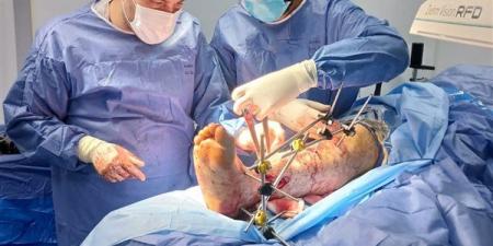 تدخل جراحي دقيق لإنقاذ مصاب بكسر مضاعف في مستشفى طلخا بالدقهلية