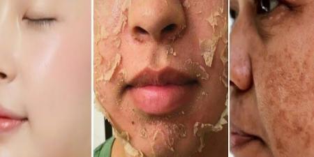 تقشير البشرة في المنزل| خطوات بسيطة لملامح نضرة وجذابة