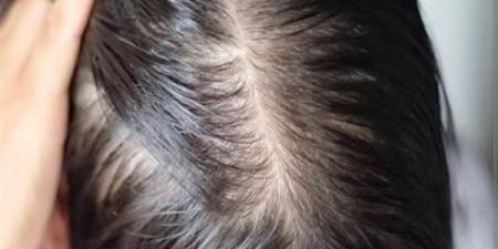 افضل زيوت لعلاج الشعر الخفيف