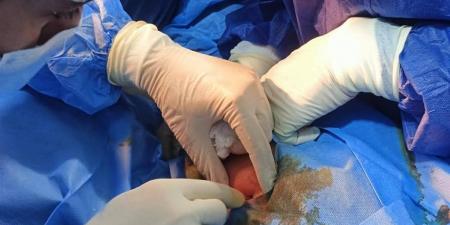 إجراء منظار تشخيصي وعلاجي بمستشفى الجمالية بالدقهلية