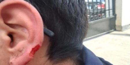 مأساة في مدرسة الشاطبي.. طالب يفقد جزءًا من أذنه بسبب "عضة"