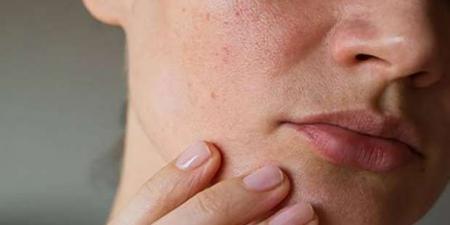 علامات الجفاف لا تقتصر على العطش.. انتبه لهذه الأعراض