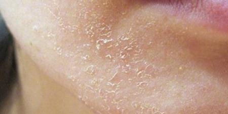 علامات تنذر بتجفاف الجسم