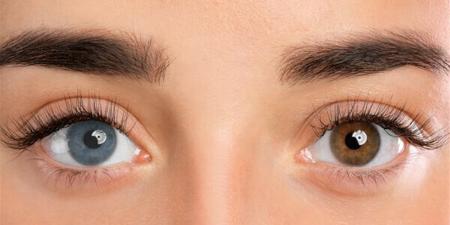 تقنية جديدة قد تنقذ الملايين من العمى