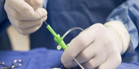 قسم القلب بجامعة قناة السويس ينجح في تدخل قسطري لإنقاذ مُسنِّة