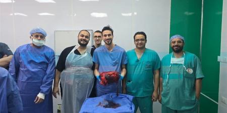 رئيس جامعة المنوفية يعلن نجاح فريق طبي في استئصال ورم نادر يزن أكثر من 30 كيلو
