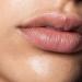 اسمرار الشفاه.. متى يكون مؤشرًا صحيًا وليس مجرد مشكلة تجميلية؟