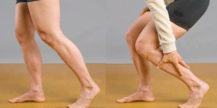أسباب تشنجات الساق.. متى يجب القلق؟