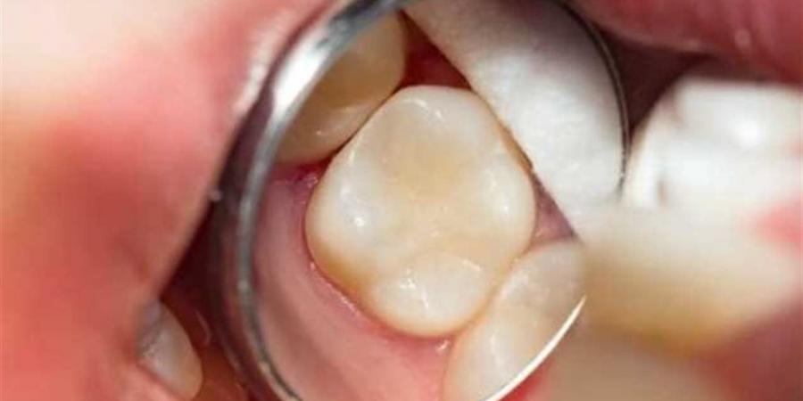تجنب وجع الأسنان.. نصائح منزلية قبل زيارة الطبيب