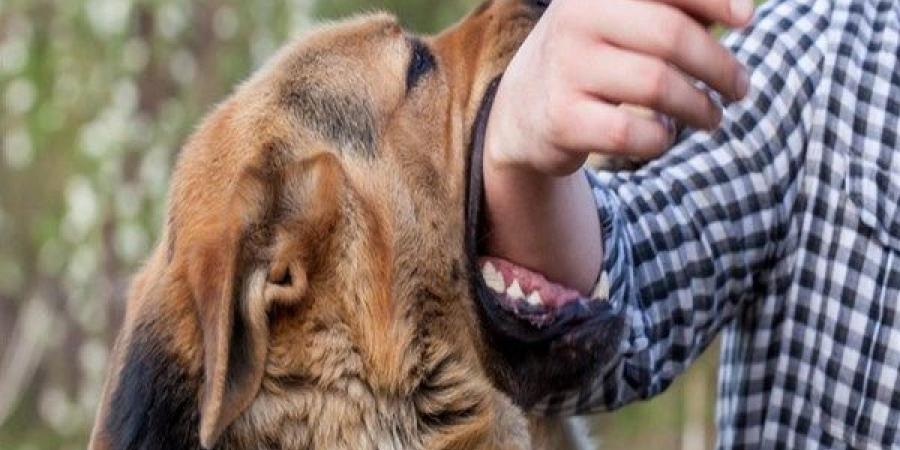 تحقيقات موسعة في واقعة عقر كلب ضال لعدد من الأهالي بالصف