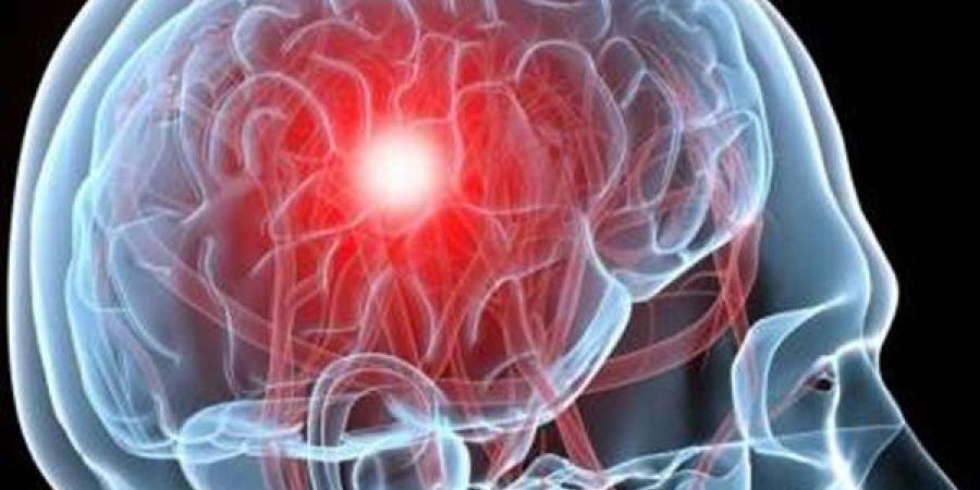 علماء يبتكرون نموذج ذكاء اصطناعي يشخص 6 أمراض دماغية بـ "بصمة دم"