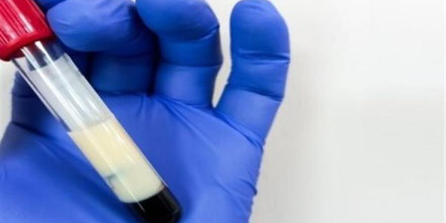 الدهون الثلاثية خطر صامت يستدعي الانتباه والوقاية