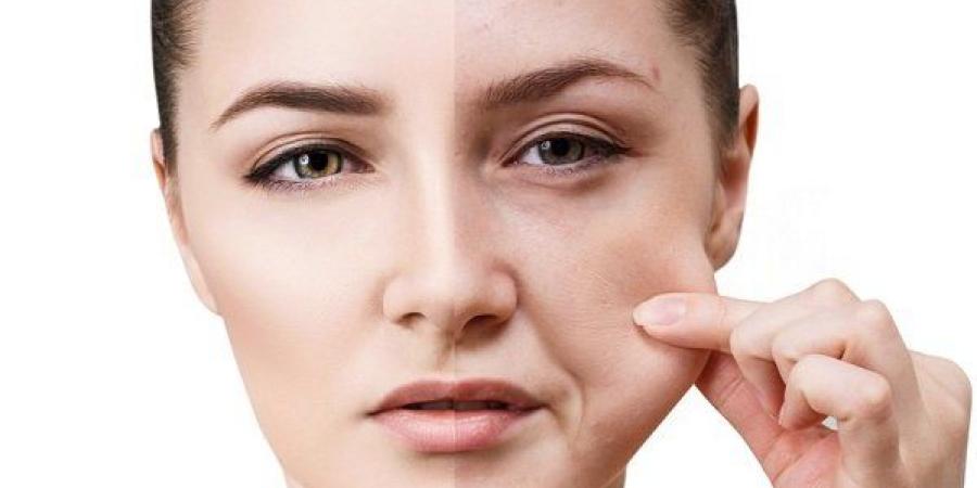 روتين العناية بالبشرة قبل المناسبات.. خطوات سريعة لبشرة مثالية في وقت قياسي