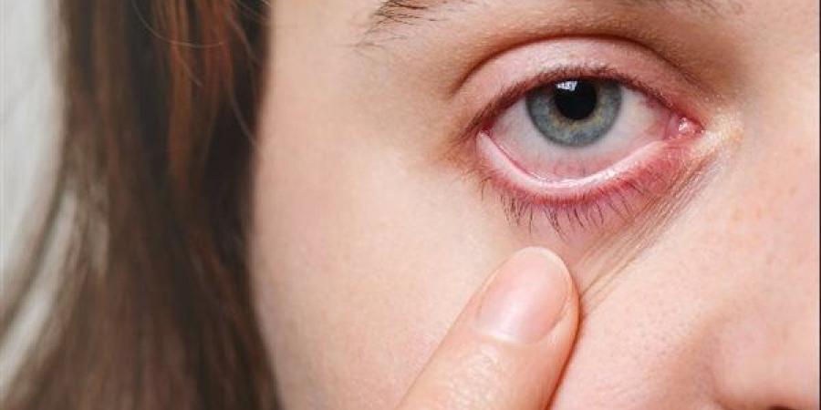 تعرف على مدى فاعلية عملية علاج جفاف العين