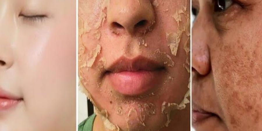 تقشير البشرة في المنزل| خطوات بسيطة لملامح نضرة وجذابة