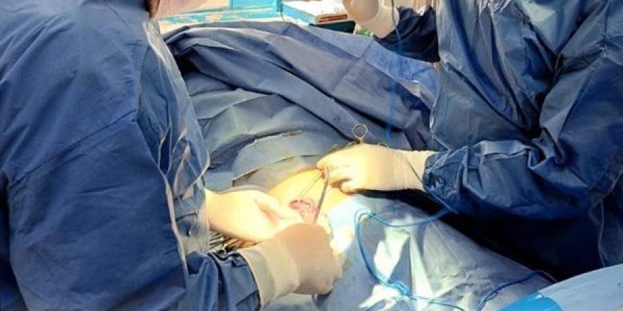 رقم قياسي لجراحات الشرقية في يوم واحد