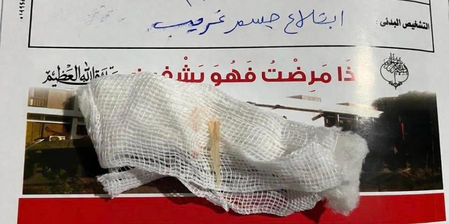 فريق بقنا العام ينقذ سيدة من شوكة سمكة وطفل من جسم بالأنف