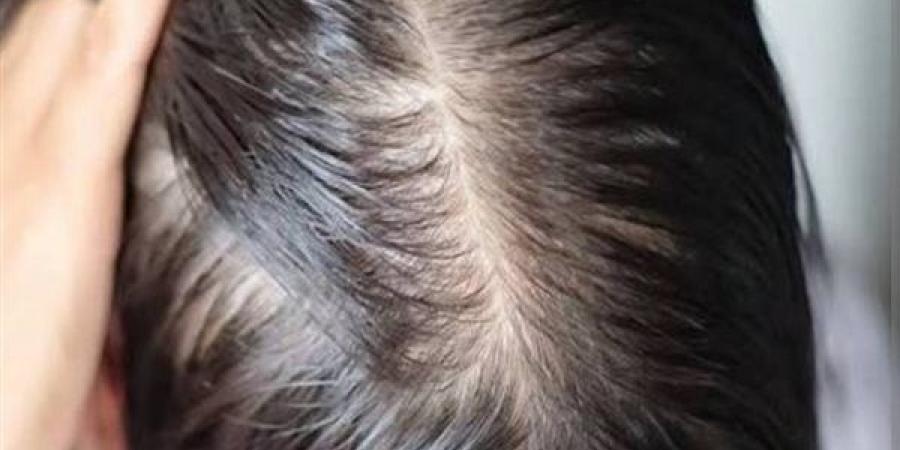 افضل زيوت لعلاج الشعر الخفيف