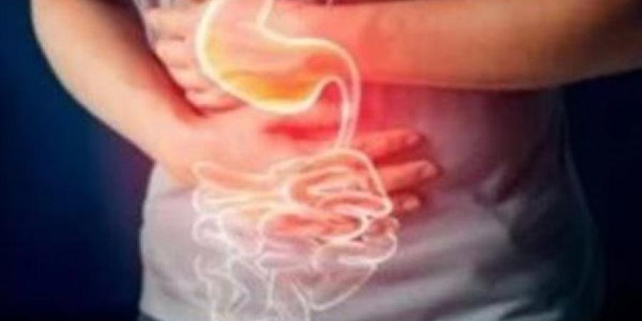 نصائح تحميك من تهيج المعدة قبل تناول الفسيخ والرنجة