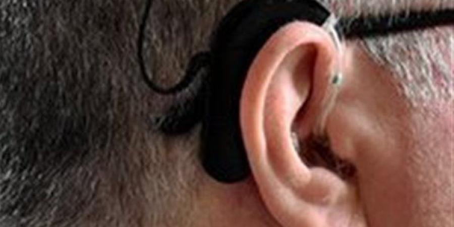 تكلفة زراعة القوقعة تتخطى المليون جنيه ومتوفرة في الرعاية الصحية بـ481 جنيها