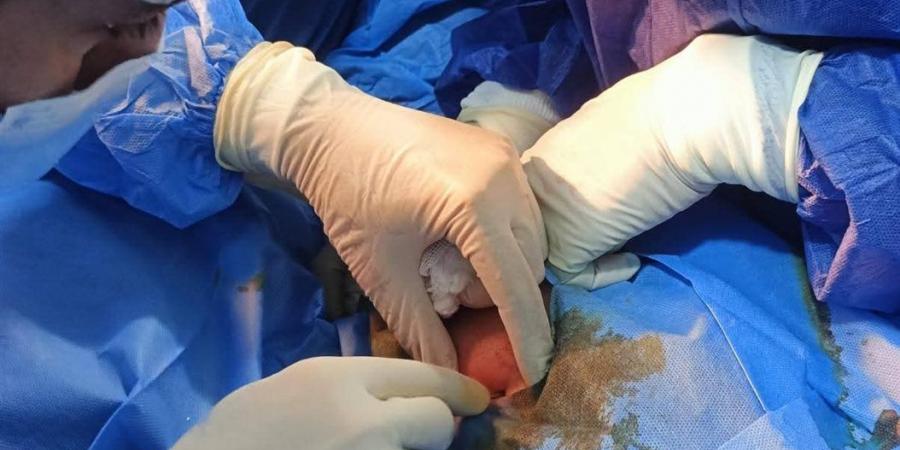 إجراء منظار تشخيصي وعلاجي بمستشفى الجمالية بالدقهلية