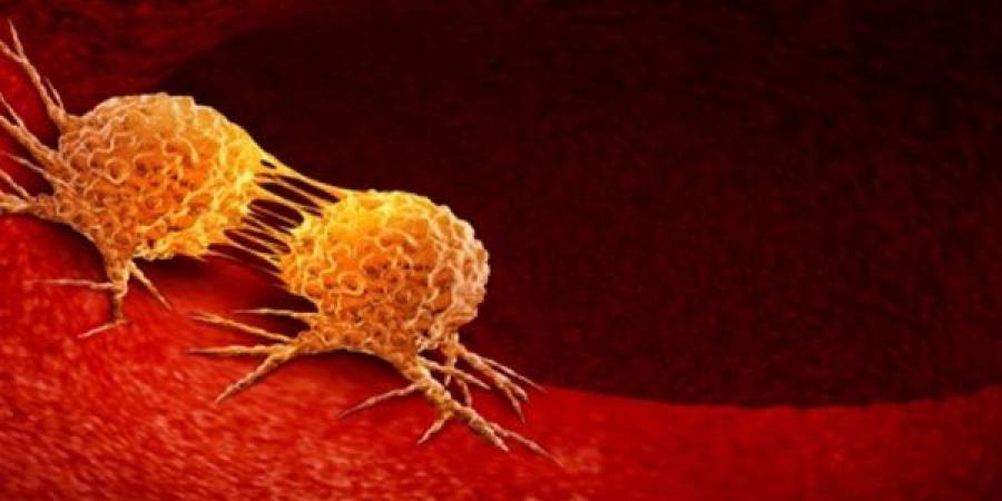 باحثون يكشفون خطوة وقائية بسيطة قد تحمي الرجال من سرطانات خطيرة