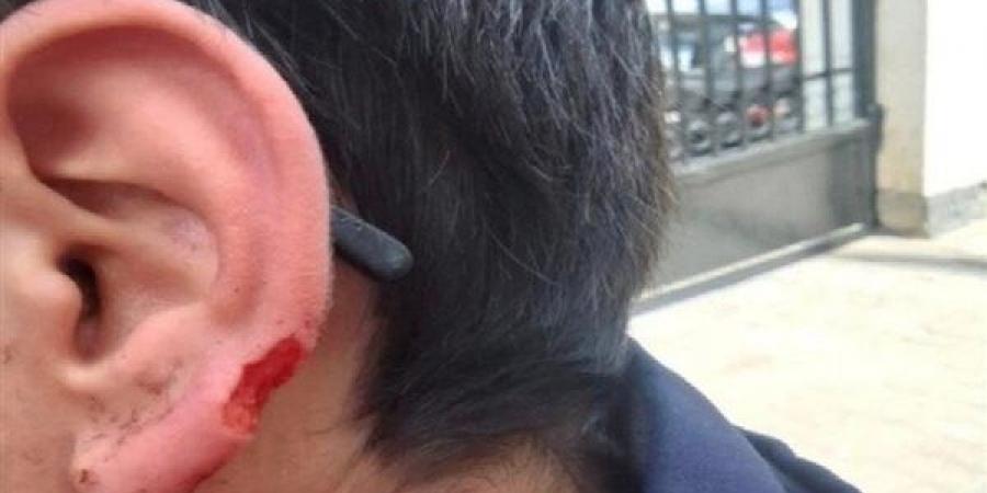 مأساة في مدرسة الشاطبي.. طالب يفقد جزءًا من أذنه بسبب "عضة"