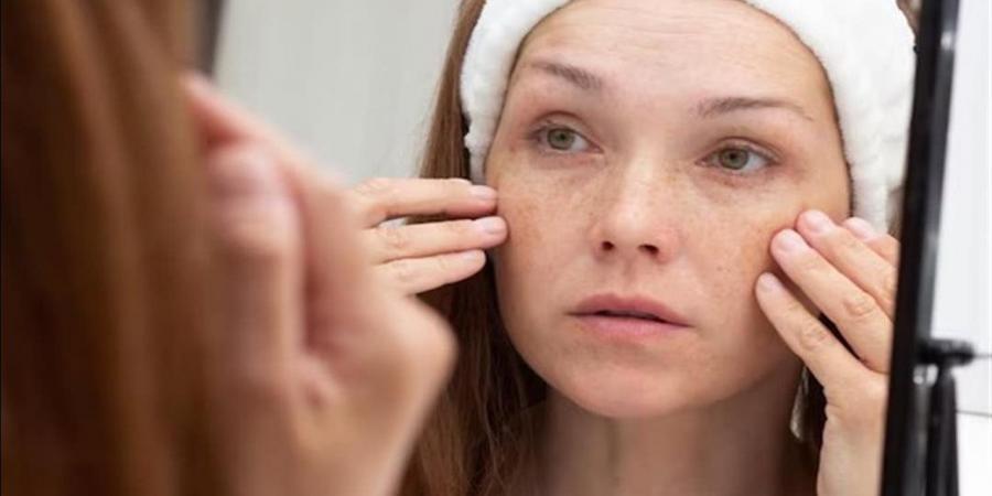 كيف تؤثر العادات الغذائية على بشرتك؟