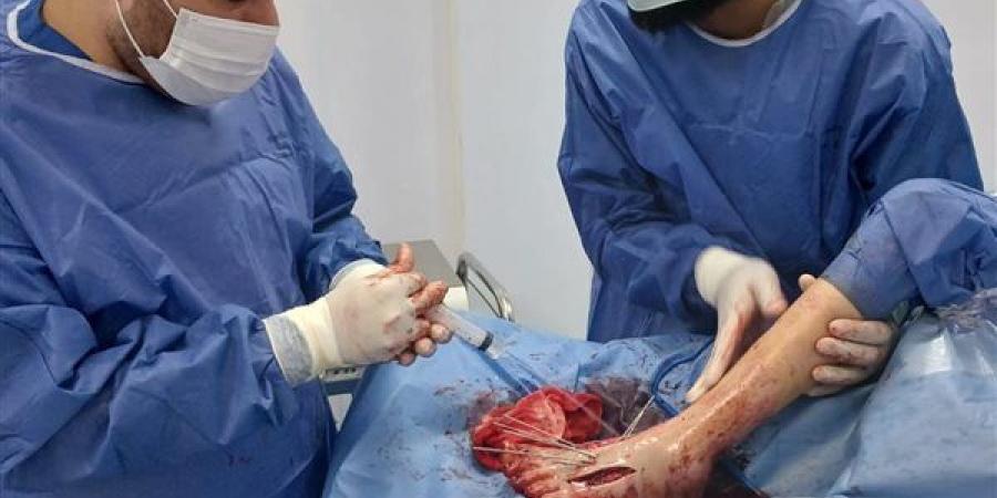 تدخل جراحي ينقذ قدم طفل من مضاعفات خطيرة بمستشفى طلخا