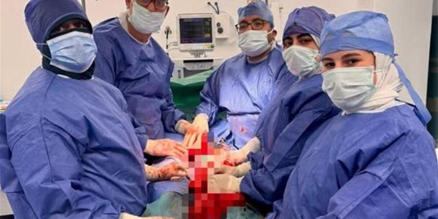 نجاح إجراء قيصرية عالية الخطورة بمستشفى العريش العام