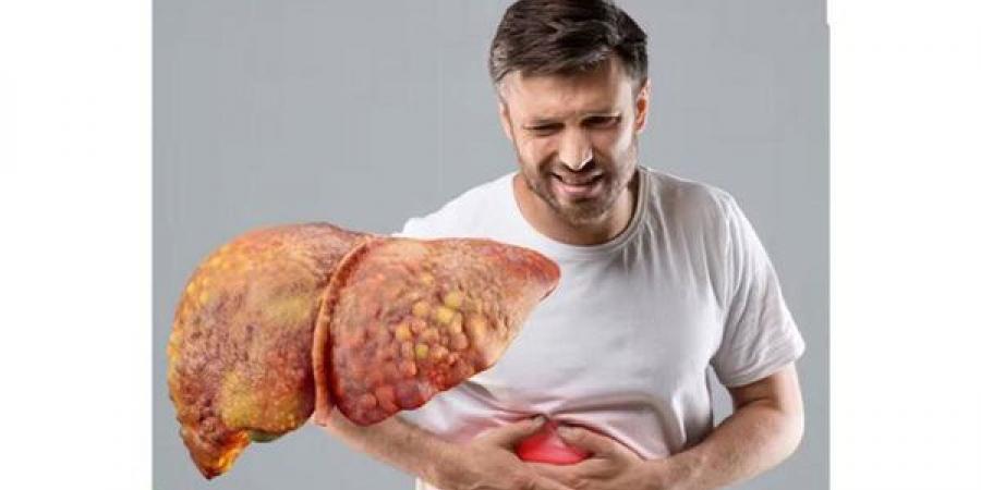 1.8 مليار شخص معرضون للإصابة بمرض الكبد الدهني.. الأسباب وطرق الوقاية