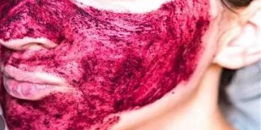 فوائد مذهله للكركديه في علاج تلف الشعر وصفاء البشرة