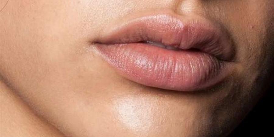 اسمرار الشفاه.. متى يكون مؤشرًا صحيًا وليس مجرد مشكلة تجميلية؟