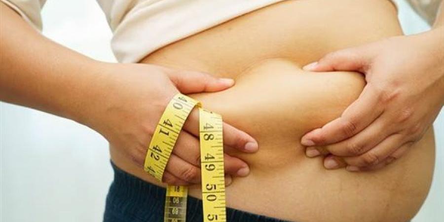 دراسة تحذر: السمنة قبل سن الثلاثين تزيد خطر الوفاة المبكرة بنسبة 70%