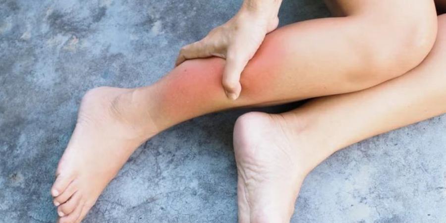 تجنبها.. أطعمة تحفز التهاب الأنسجة تحت الجلد وأبرز بدائلها المفيدة